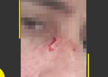 Agente da Transalvador acusa PM por agressão e ameaça