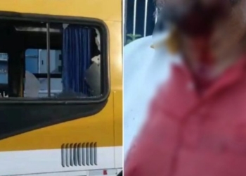Motorista de ônibus é agredido com pedrada no rosto após desentendimento com passageiro em Salvador
